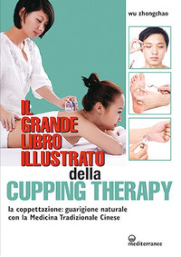 Il grande libro illustrato della cupping therapy